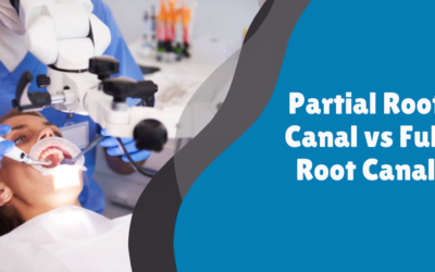 Partial Root Canal vs Full Root Canal: What You Need to Know