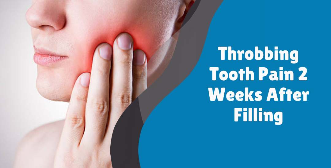 Throbbing Tooth Pain 2 Weeks After Filling