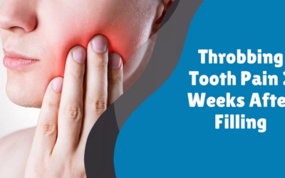 Throbbing Tooth Pain 2 Weeks After Filling