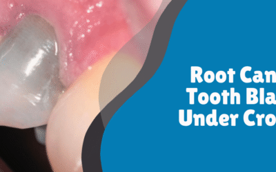 Root Canal Tooth Black Under Crown