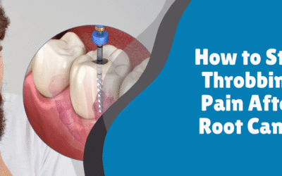 How to Stop Throbbing Pain After Root Canal | Evershine Dental Clinic