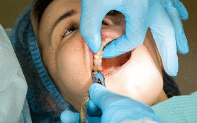 Wisdom Tooth Removal in Chembur: When Is It Necessary & What to Expect After the Procedure