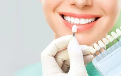 Veneers & Laminates in Chembur: Who Should Consider Smile Enhancement Treatments?