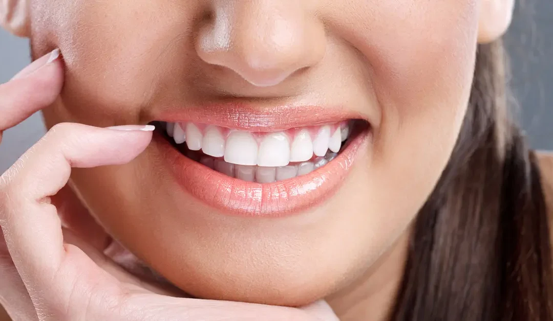 Teeth Whitening in Chembur: Professional Whitening vs Home Remedies