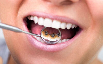 Why Do My Teeth Hurt? 10 Common Causes of Tooth Pain and When to See a Dentist