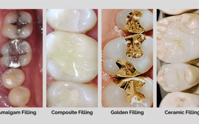 Cavity Symptoms: 10 Signs of Tooth Decay You Should Not Ignore